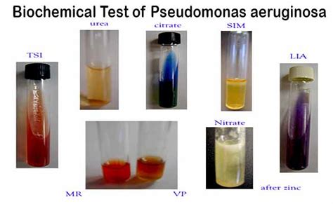 pseudomonas aeruginosa biochemical test results